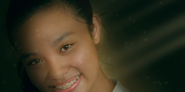 Are Braces Only for Teens